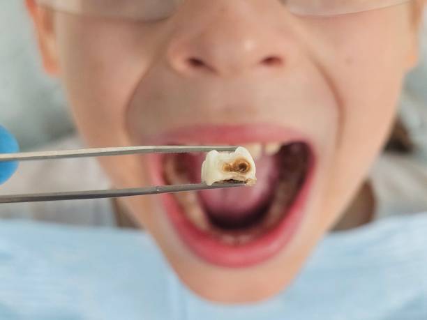 Best Weekend Emergency Dental Services in Winnsboro, LA